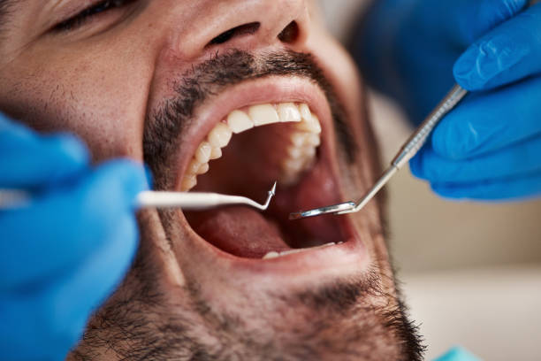 Best Tooth Infection Emergency Dentist  in Palm Valley, FL